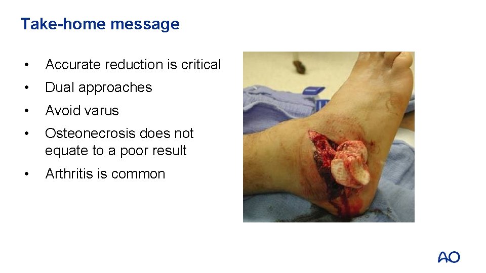 Take-home message • Accurate reduction is critical • Dual approaches • Avoid varus •