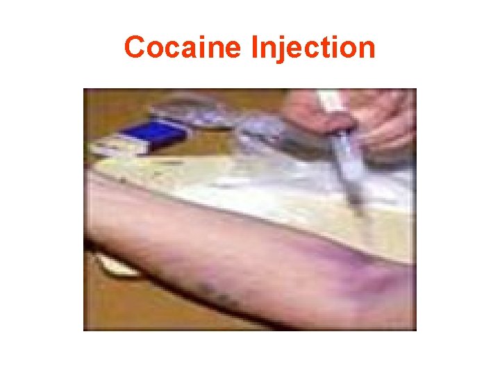 Cocaine Injection 