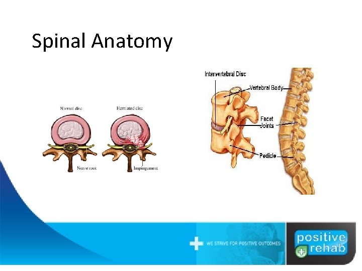 Spinal Anatomy Vertebra and joints Intervertebral discs are the shock absorbers Ligaments connect bone