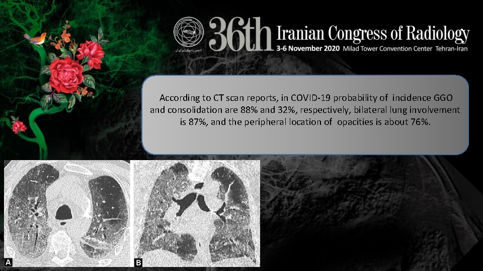 According to CT scan reports, in COVID-19 probability of incidence GGO and consolidation are According to CT scan reports, in COVID-19 probability of incidence GGO and consolidation are