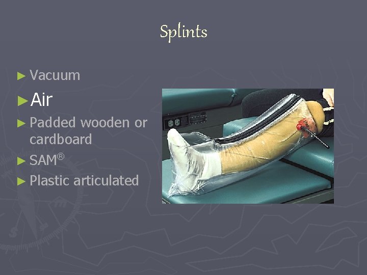 Splints ► Vacuum ►Air ► Padded wooden or cardboard ® ► SAM ► Plastic