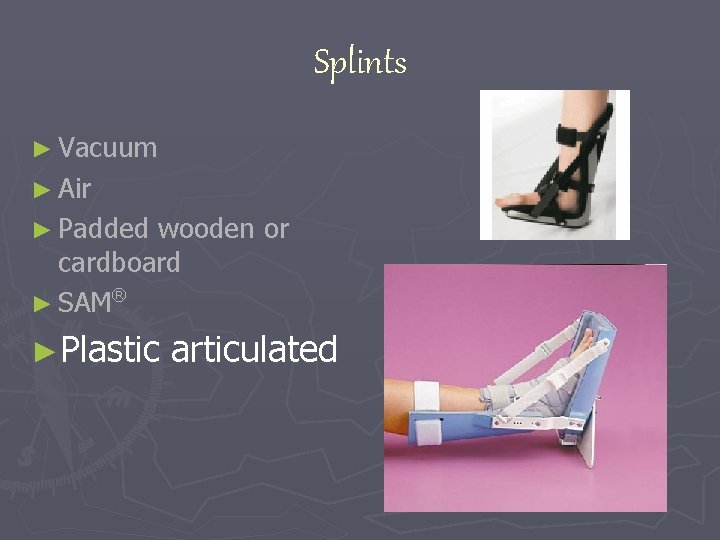 Splints ► Vacuum ► Air ► Padded wooden or cardboard ® ► SAM ►Plastic