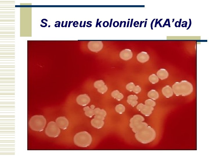 S. aureus kolonileri (KA’da) 