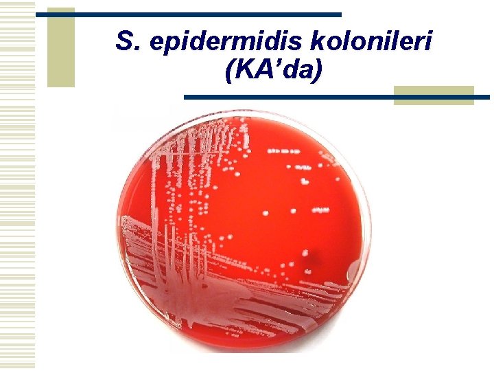 S. epidermidis kolonileri (KA’da) 