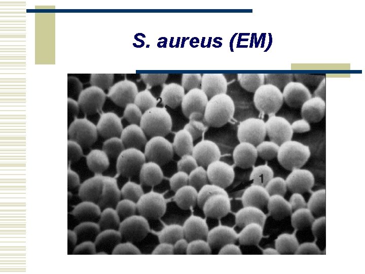 S. aureus (EM) 