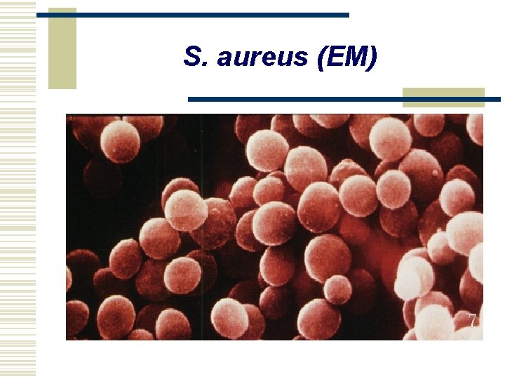 S. aureus (EM) 