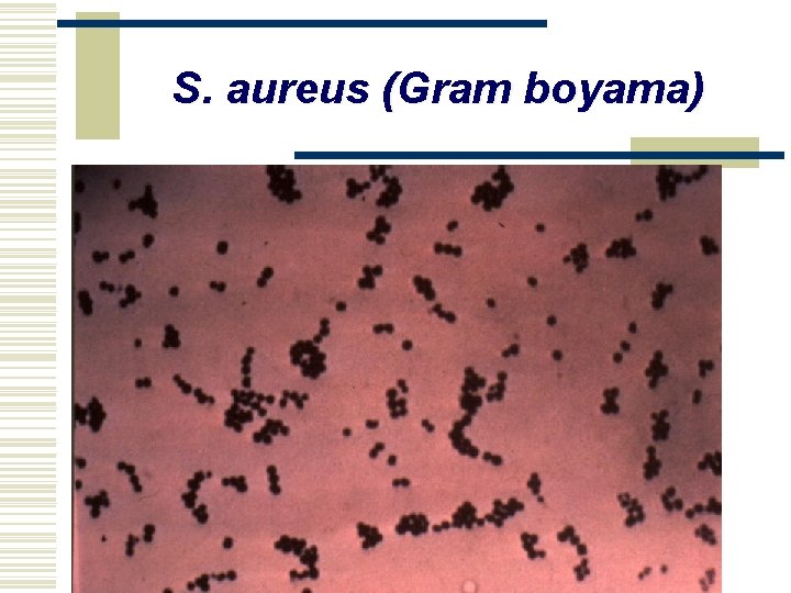 S. aureus (Gram boyama) 