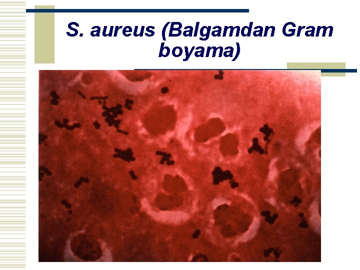 S. aureus (Balgamdan Gram boyama) 