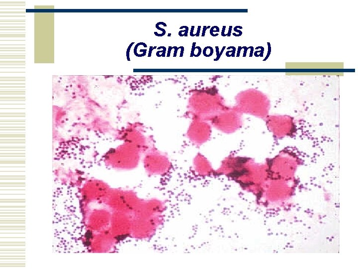 S. aureus (Gram boyama) 