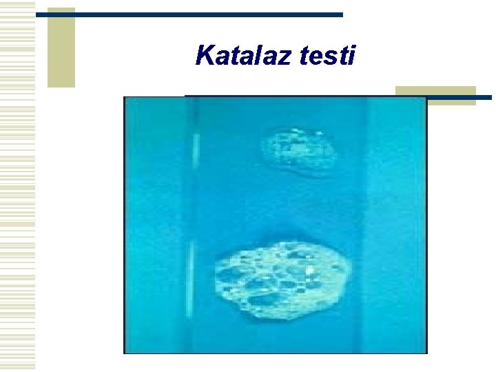 Katalaz testi 