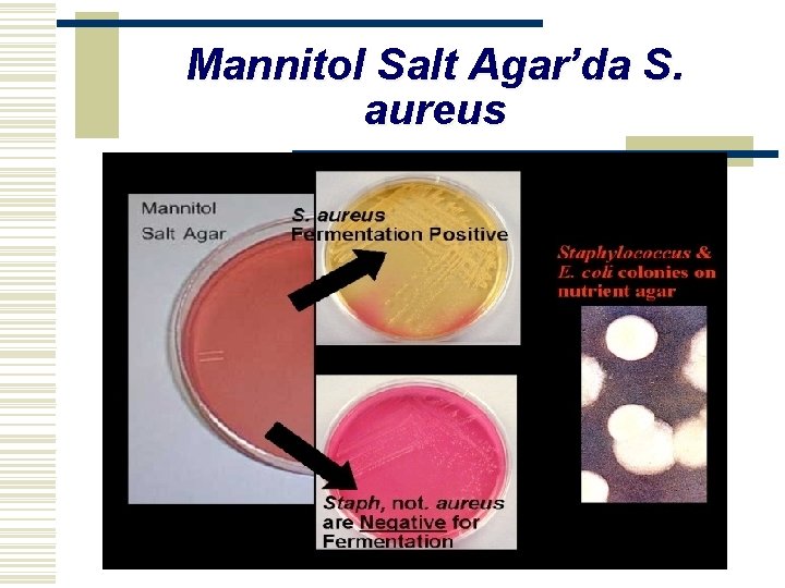 Mannitol Salt Agar’da S. aureus 