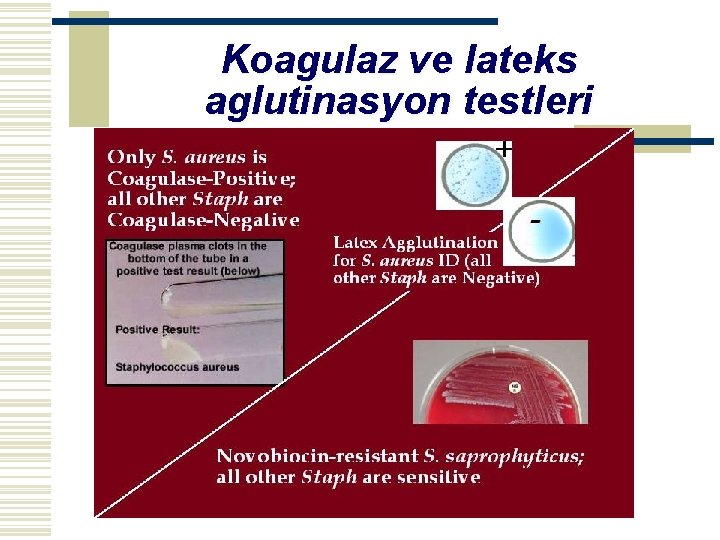 Koagulaz ve lateks aglutinasyon testleri 