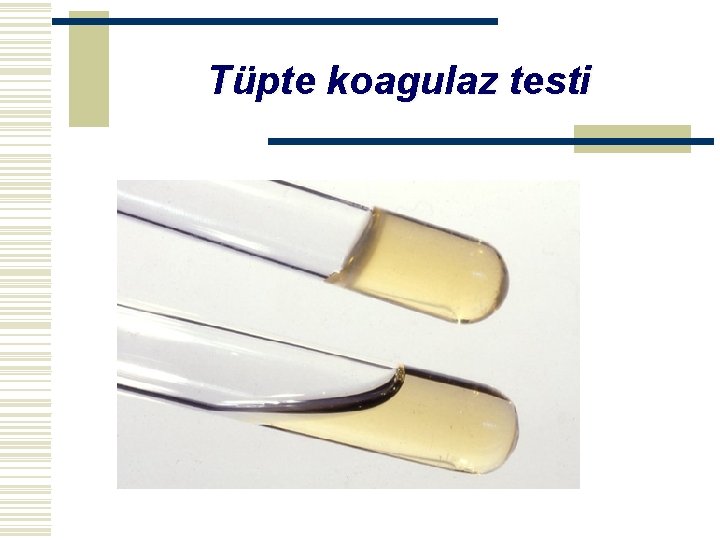 Tüpte koagulaz testi 