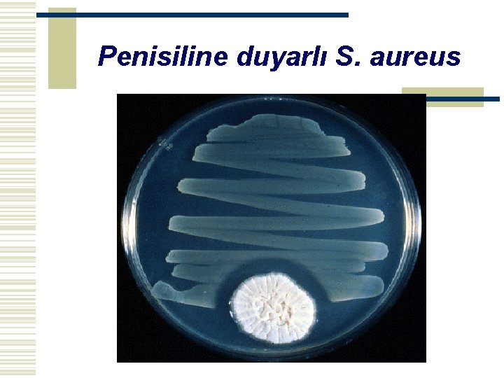 Penisiline duyarlı S. aureus 