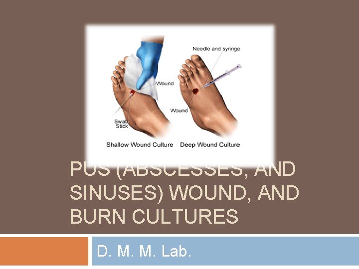 PUS (ABSCESSES, AND SINUSES) WOUND, AND BURN CULTURES D. M. M. Lab. 