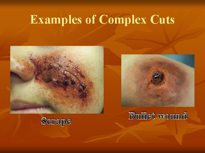 Examples of Complex Cuts Scrape Bullet wound 