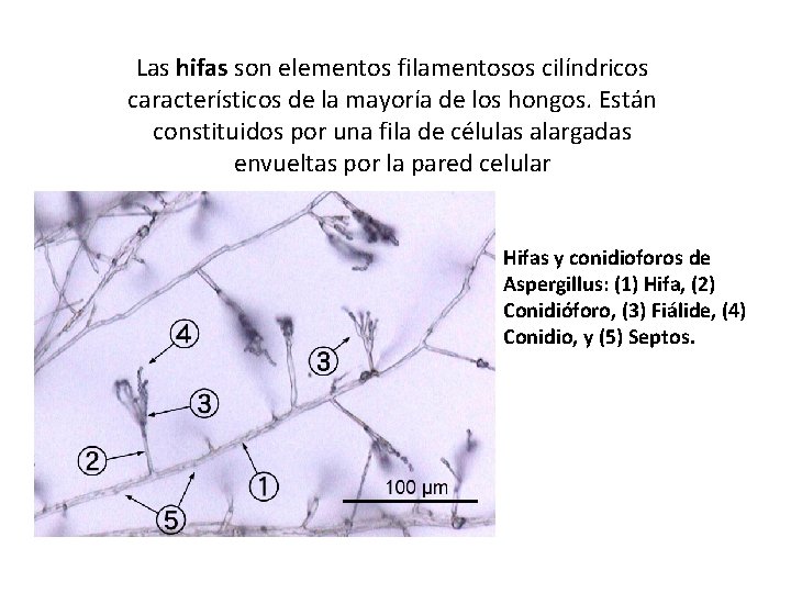 Las hifas son elementos filamentosos cilíndricos característicos de la mayoría de los hongos. Están