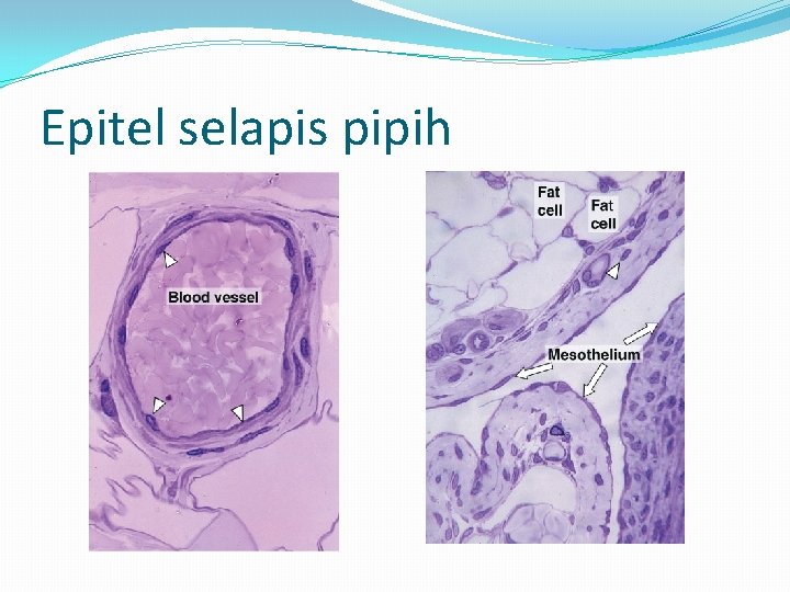 Epitel selapis pipih 