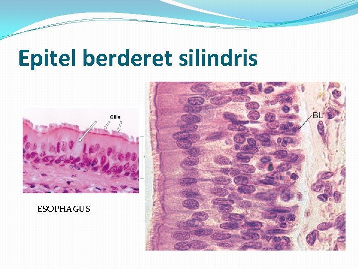 Epitel berderet silindris ESOPHAGUS 