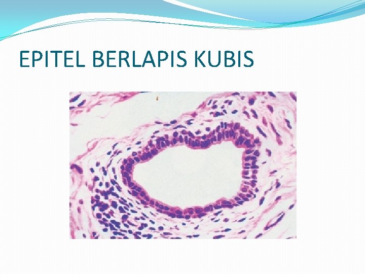 EPITEL BERLAPIS KUBIS 