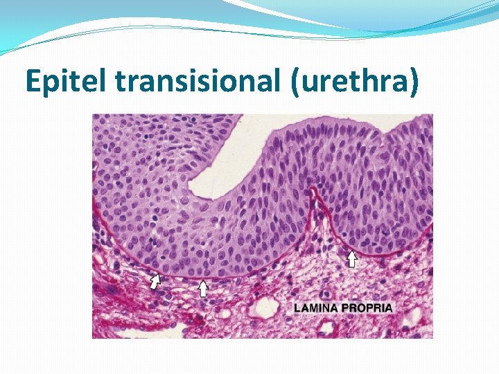 Epitel transisional (urethra) 