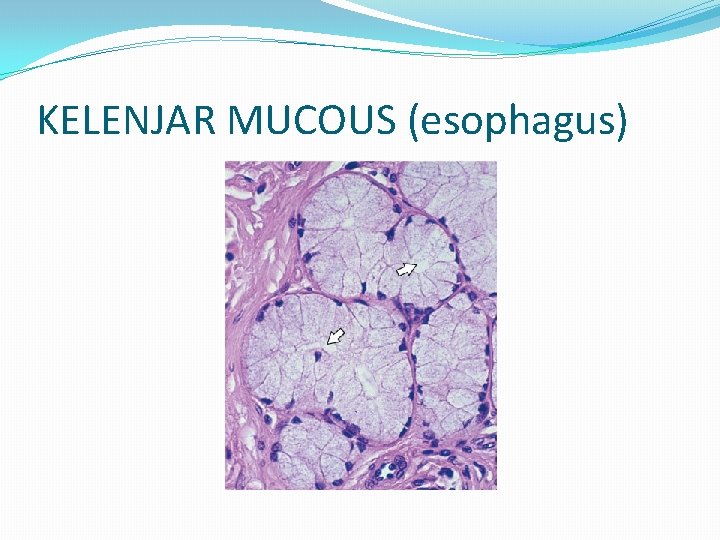 KELENJAR MUCOUS (esophagus) 