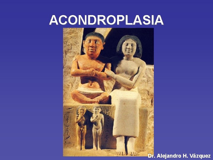 ACONDROPLASIA Dr. Alejandro H. Vázquez 