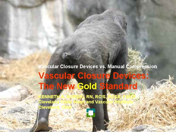 Vascular Closure Devices vs. Manual Compression Vascular Closure Devices: The New Gold Standard KENNETH