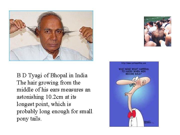 B D Tyagi of Bhopal in India The hair growing from the middle of