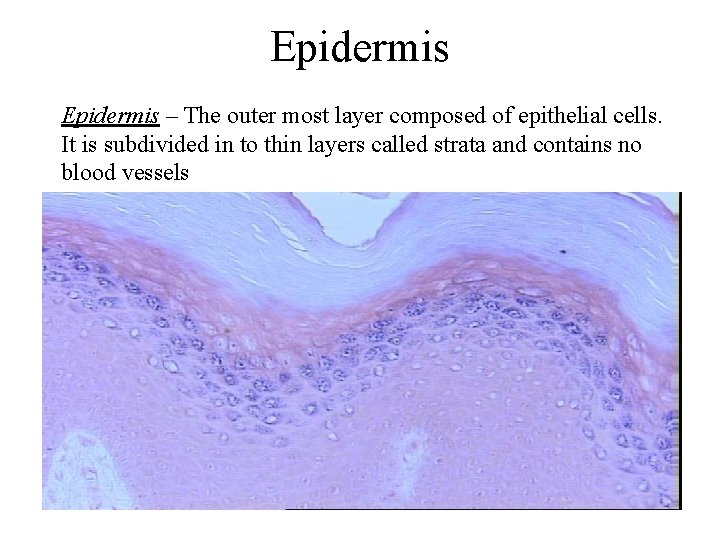 Epidermis – The outer most layer composed of epithelial cells. It is subdivided in