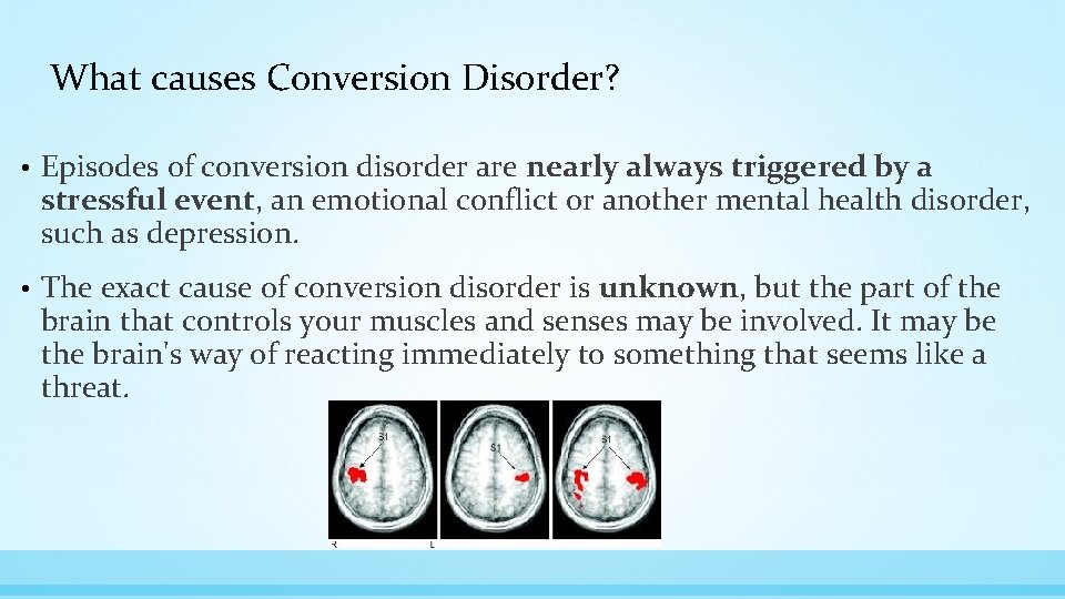 What causes Conversion Disorder? • Episodes of conversion disorder are nearly always triggered by