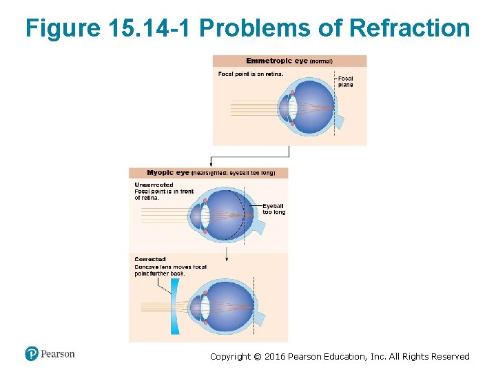 Figure 15. 14 -1 Problems of Refraction Copyright © 2016 Pearson Education, Inc. All