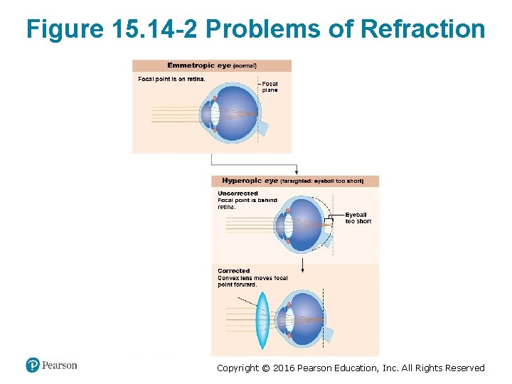 Figure 15. 14 -2 Problems of Refraction Copyright © 2016 Pearson Education, Inc. All