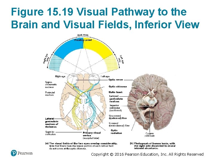 Figure 15. 19 Visual Pathway to the Brain and Visual Fields, Inferior View Copyright