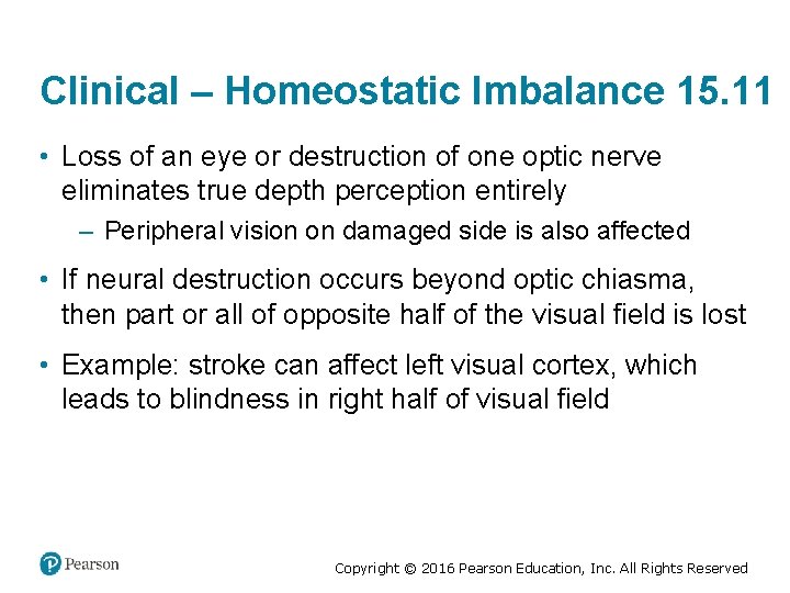 Clinical – Homeostatic Imbalance 15. 11 • Loss of an eye or destruction of