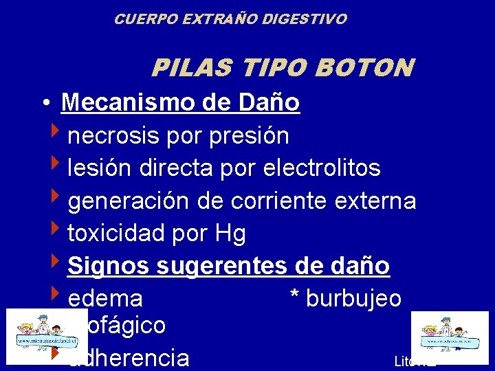 CUERPO EXTRAÑO DIGESTIVO PILAS TIPO BOTON • Mecanismo de Daño 4 necrosis por presión