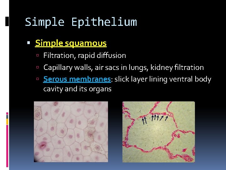 Simple Epithelium Simple squamous Filtration, rapid diffusion Capillary walls, air sacs in lungs, kidney Simple Epithelium Simple squamous Filtration, rapid diffusion Capillary walls, air sacs in lungs, kidney