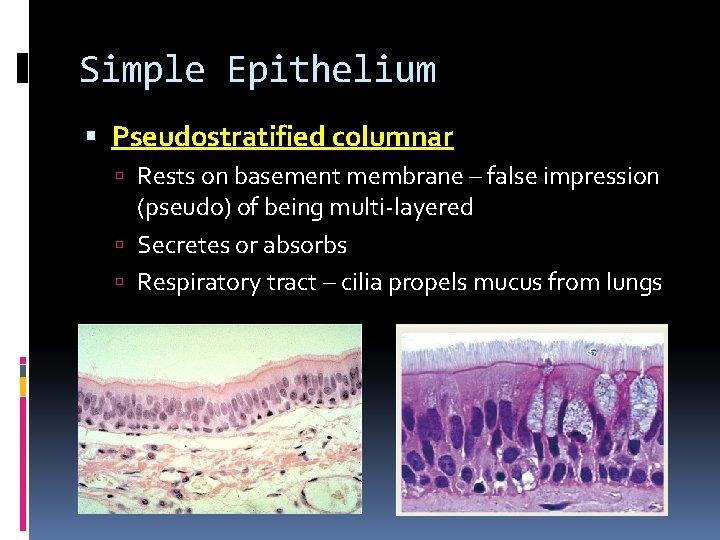 Simple Epithelium Pseudostratified columnar Rests on basement membrane – false impression (pseudo) of being Simple Epithelium Pseudostratified columnar Rests on basement membrane – false impression (pseudo) of being