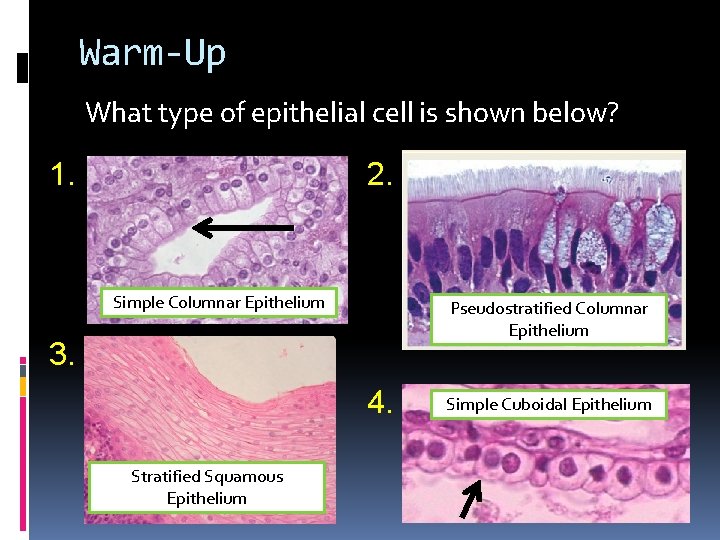 Warm-Up What type of epithelial cell is shown below? 1. 2. Simple Columnar Epithelium Warm-Up What type of epithelial cell is shown below? 1. 2. Simple Columnar Epithelium