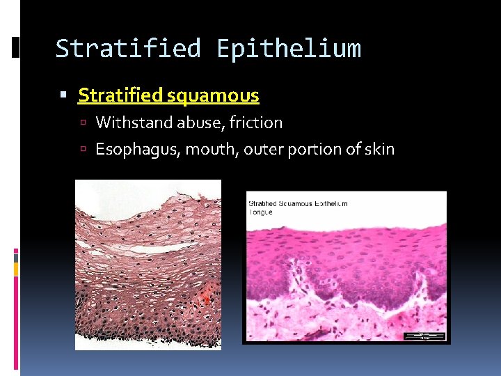 Stratified Epithelium Stratified squamous Withstand abuse, friction Esophagus, mouth, outer portion of skin Stratified Epithelium Stratified squamous Withstand abuse, friction Esophagus, mouth, outer portion of skin