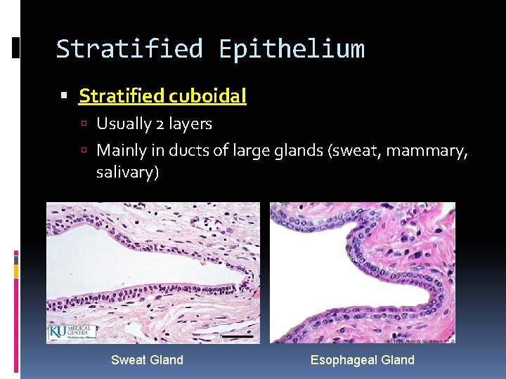 Stratified Epithelium Stratified cuboidal Usually 2 layers Mainly in ducts of large glands (sweat, Stratified Epithelium Stratified cuboidal Usually 2 layers Mainly in ducts of large glands (sweat,