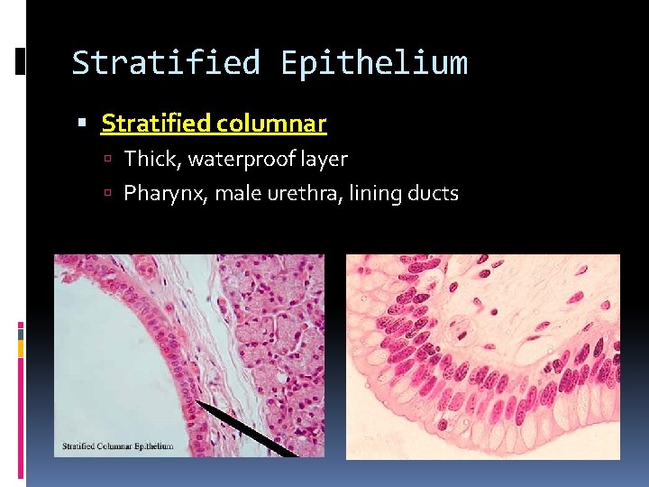 Stratified Epithelium Stratified columnar Thick, waterproof layer Pharynx, male urethra, lining ducts Stratified Epithelium Stratified columnar Thick, waterproof layer Pharynx, male urethra, lining ducts
