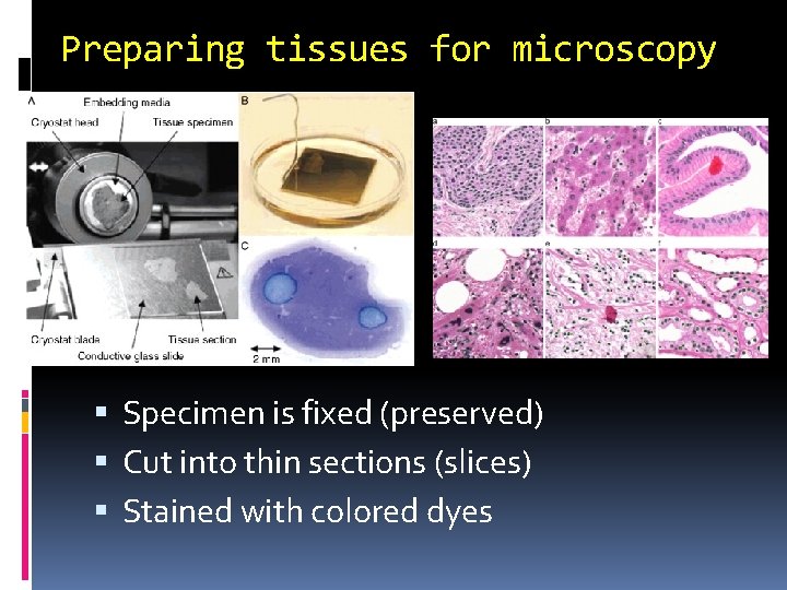 Preparing tissues for microscopy Specimen is fixed (preserved) Cut into thin sections (slices) Stained Preparing tissues for microscopy Specimen is fixed (preserved) Cut into thin sections (slices) Stained