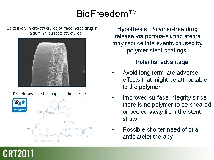 The Biofreedom Surface Etching PolymerFree DES System 12