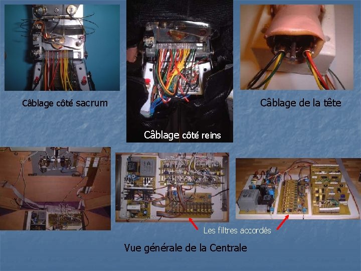 Câblage côté sacrum Câblage de la tête Câblage côté reins Les filtres accordés Vue