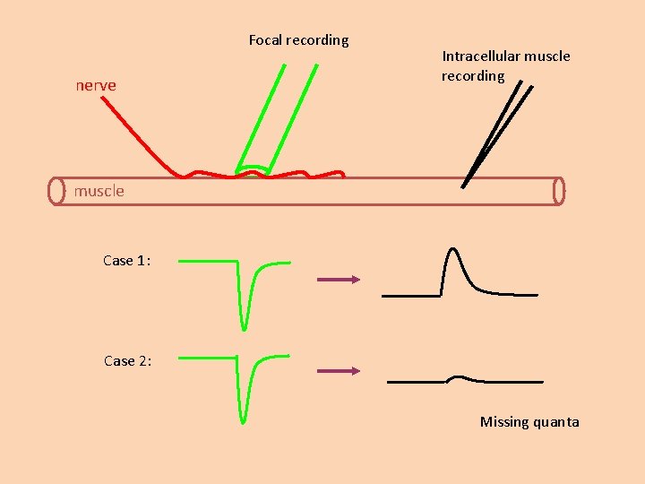 Focal recording nerve Intracellular muscle recording muscle Case 1: Case 2: Missing quanta 