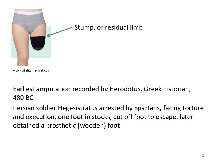 Stump, or residual limb www. vitalitymedical. com Earliest amputation recorded by Herodotus, Greek historian,