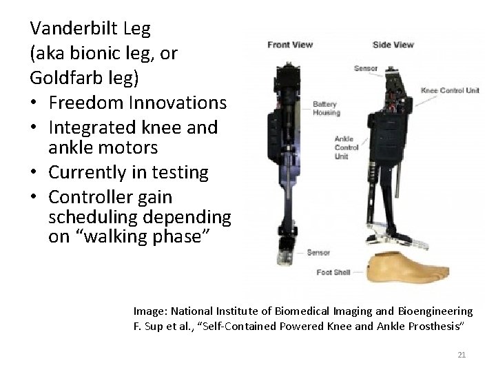 Vanderbilt Leg (aka bionic leg, or Goldfarb leg) • Freedom Innovations • Integrated knee