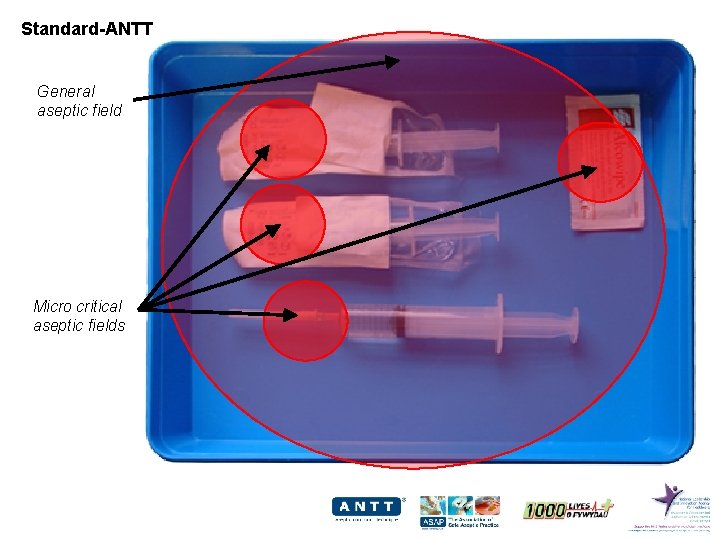 Standard-ANTT General aseptic field Micro critical aseptic fields 