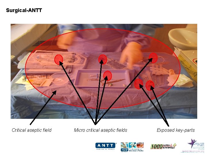Surgical-ANTT Critical aseptic field Micro critical aseptic fields Exposed key-parts 